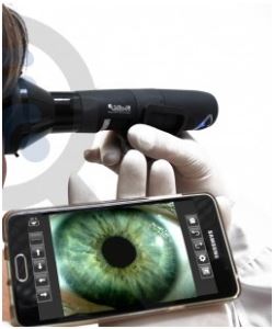 Wi-Fi MICROSCOPES FOR IRIDOLOGY